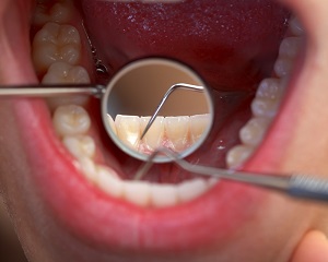 これからの歯科治療
