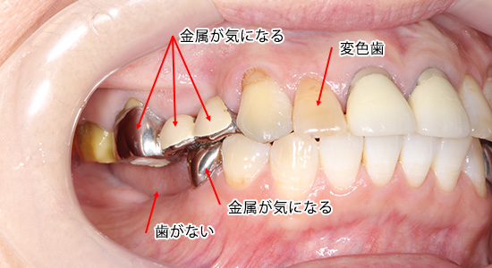 症例